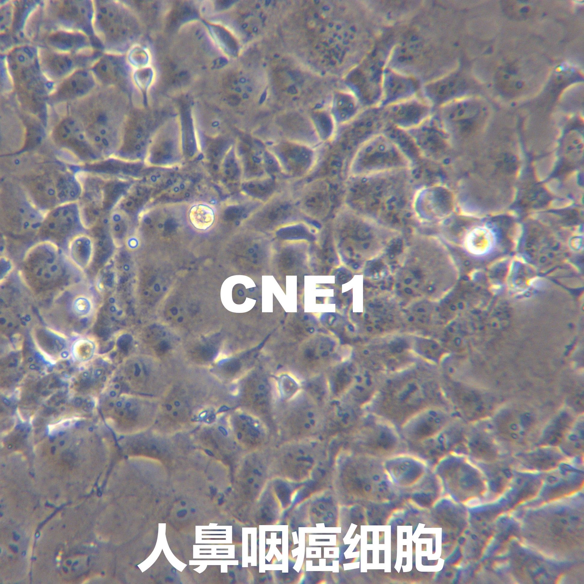 CNE-1【CNE1; CNE】人鼻咽癌细胞
