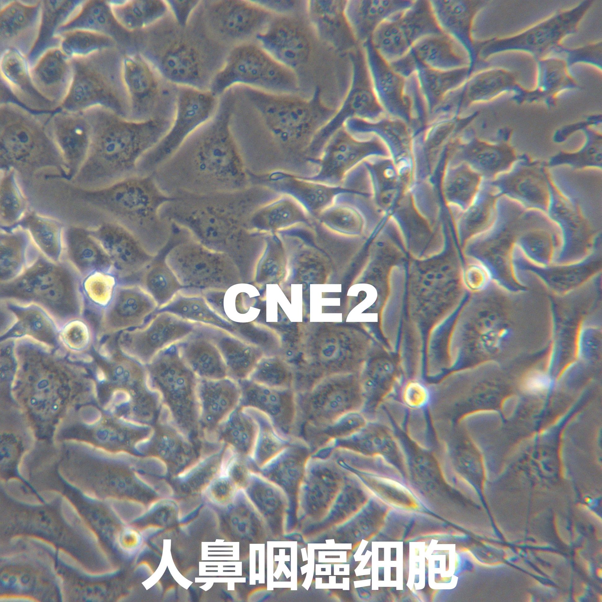 CNE-2【CNE2】鼻咽癌细胞