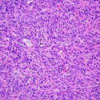 磷钨酸苏木.精染色实验服务