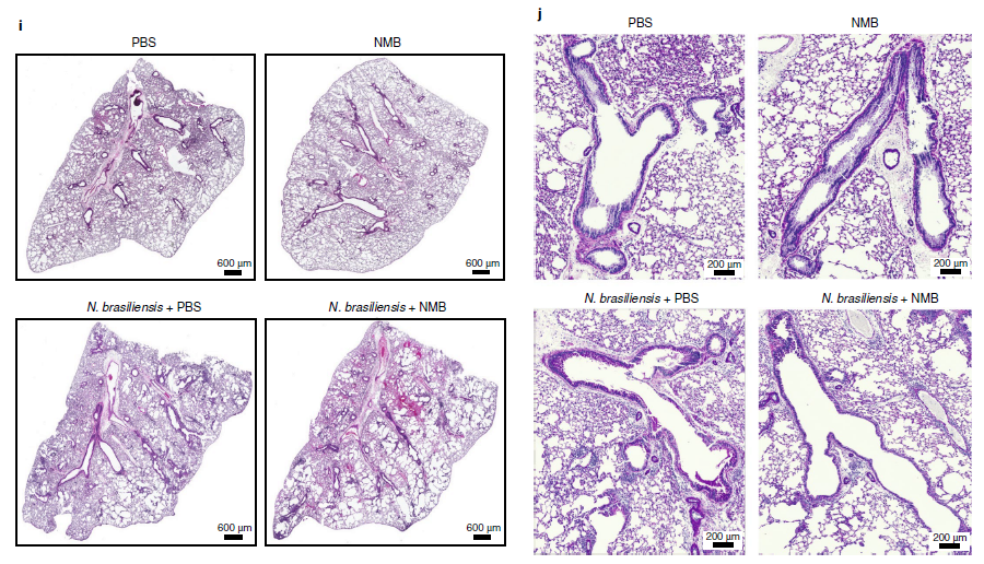 Nature Immunology:神经调节肽B有望治疗炎症性疾病