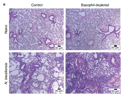 Nature Immunology:神经调节肽B有望治疗炎症性疾病