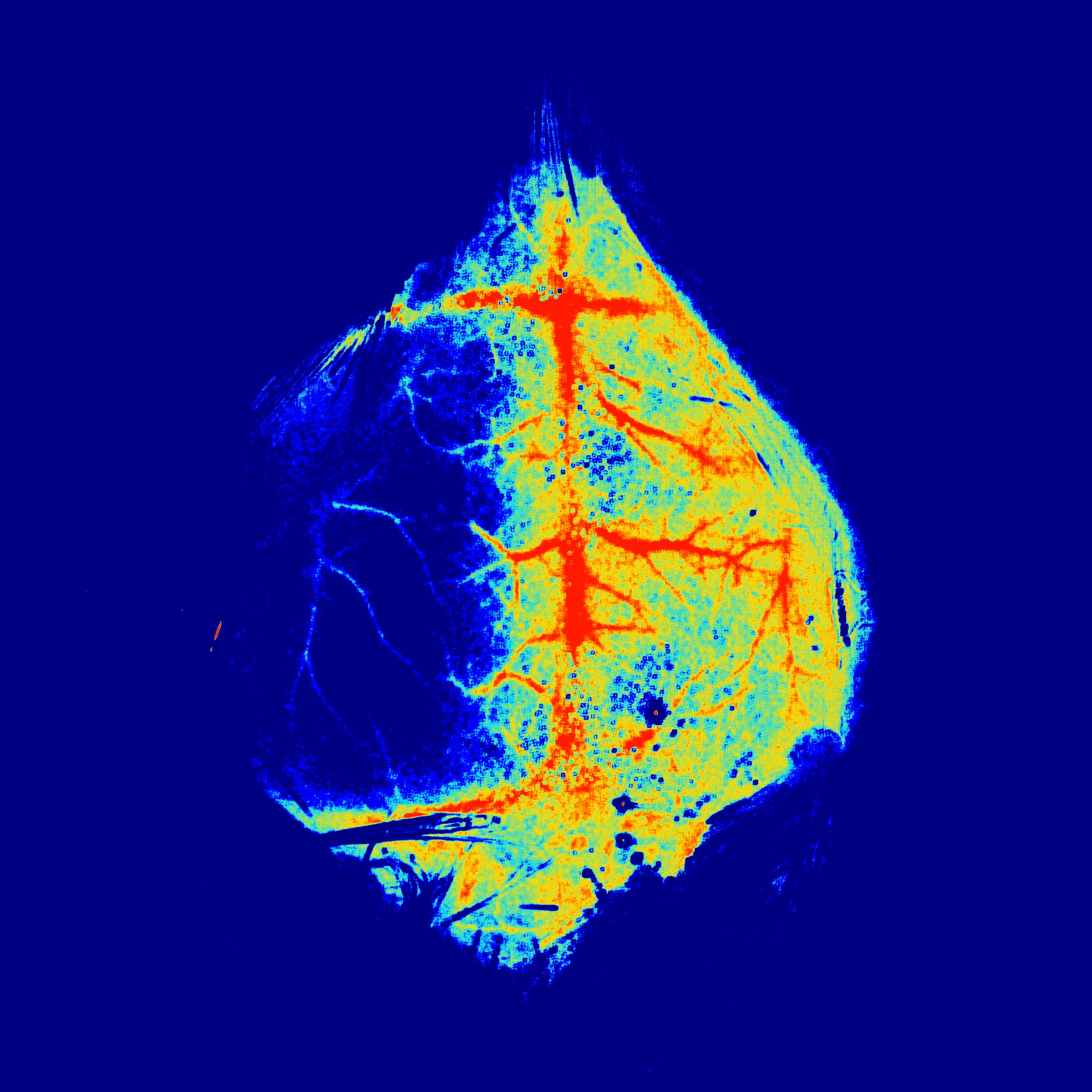 技术干货 | MCAO造模方法及如何提高成功率