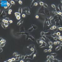 PATU 8988t细胞 | PATU8988t细胞 | PATU-8988t细胞 | 人胰腺