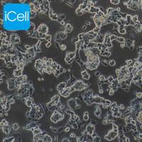 MCF-7细胞 | MCF7细胞 | MCF-7 | MCF7 | MCF-7 人乳腺癌细胞 | STR鉴定 | 镜像绮点(Cellverse)