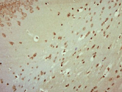 JNK1/2/3 (phospho-Thr183/185) 