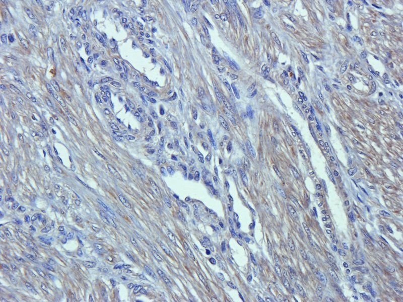 Emp1 antibody抗体，biorbyt，orb105