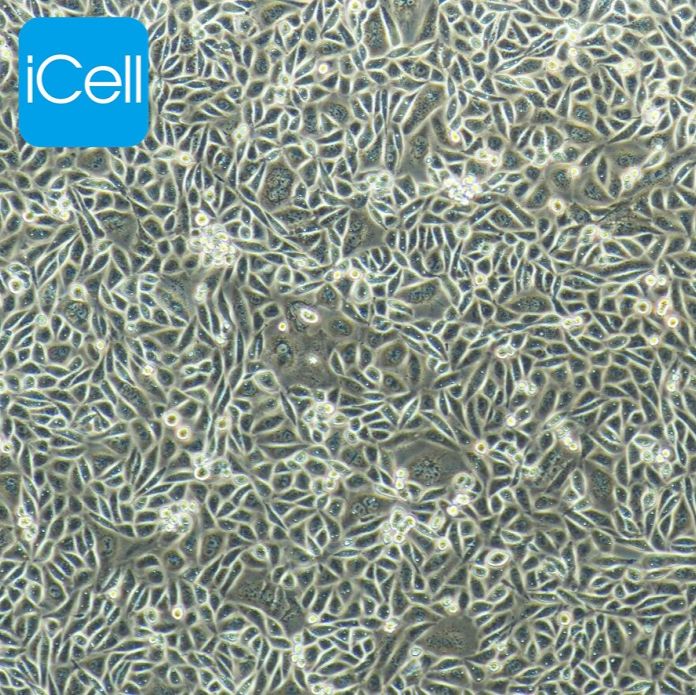 OV-90 人卵巢癌细胞/STR鉴定/镜像绮点（Cellverse）