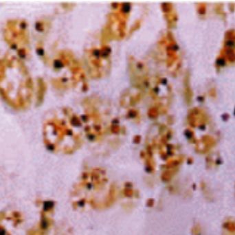 核仁组成区嗜银-AGNOR染色实验服务