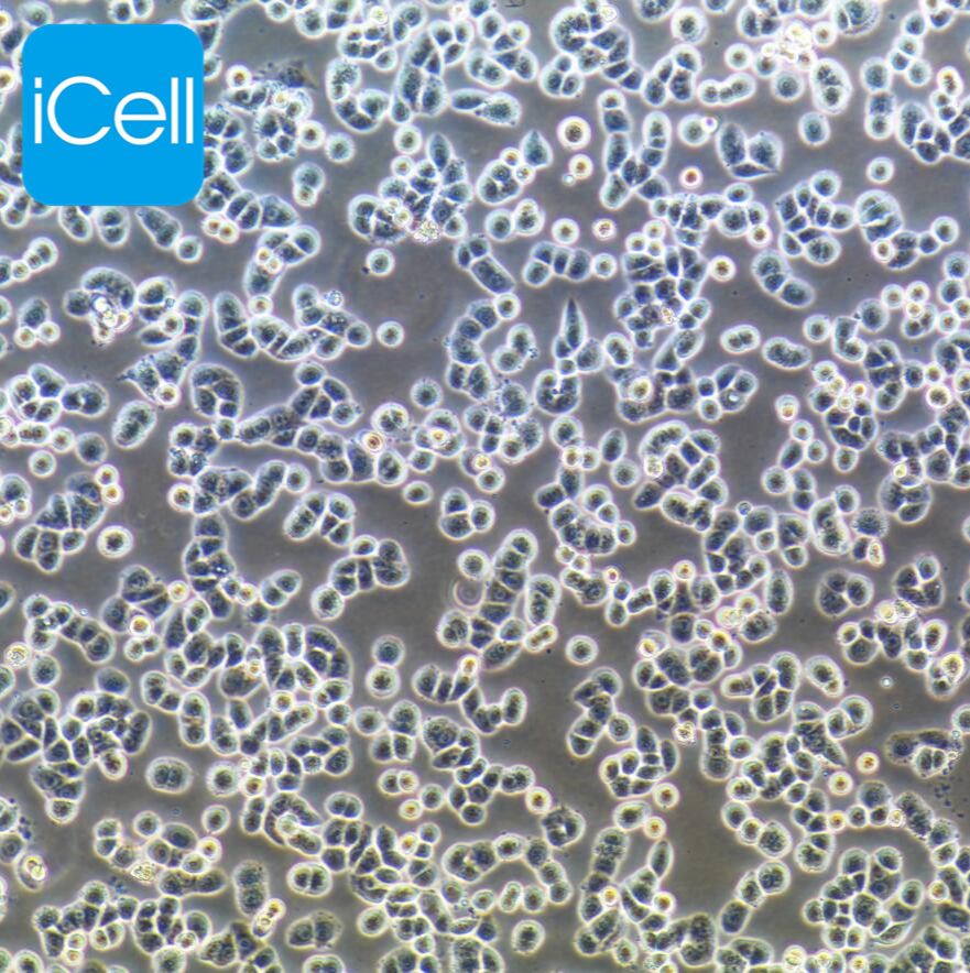 MDA-MB-468 人乳腺癌细胞/STR鉴定/镜像绮点（Cellverse）