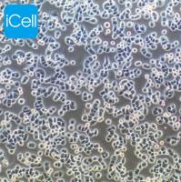 MDA-MB-468、MDA-MB-468细胞、MDAMB468细胞、MDAMB468人乳