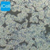 Hep G2.2.15 人肝癌(HBV) /STR鉴定/镜像绮点（Cellverse）