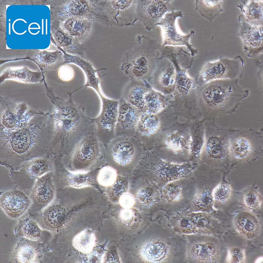 NCI-H660 人神经内分泌前列腺癌细胞/STR鉴定