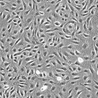 capan-2人胰腺癌细胞 