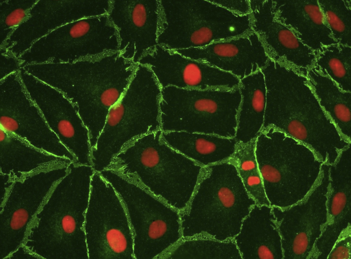 小鼠胚胎成纤维细胞CF-1 MEF