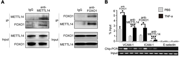 河南省人民医院李牧蔚团队揭示m6A修饰在动脉粥样硬化中的作用