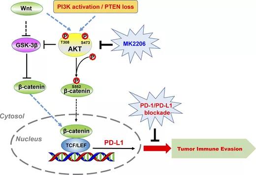 胶质瘤母细胞免疫逃逸新机制发现