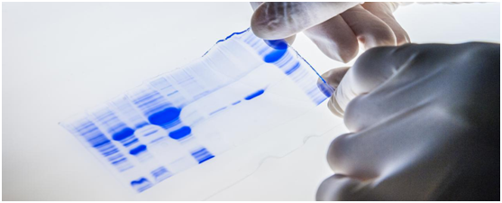 蛋白电泳凝胶精良产品-源于它的创造、应用与价值