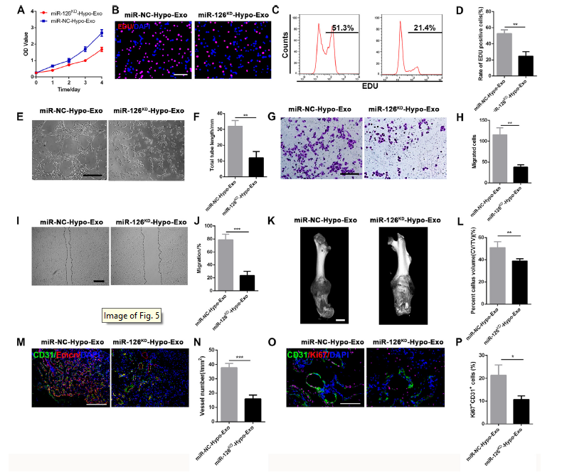 南京医科大学揭示MSC来源的外泌体对骨折愈合的作用