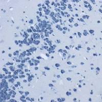 神经元尼氏染色实验代做