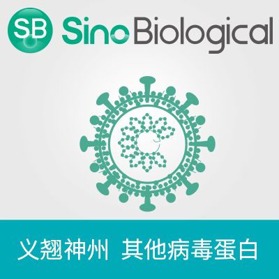 SIV gp120 蛋白|SIV gp120 protein|SIV gp120(SIV, His Tag)