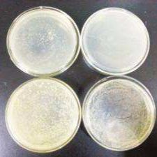菌株检测|细菌耐药性检测