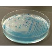 科玛嘉小肠结肠炎耶尔森氏菌显色平板