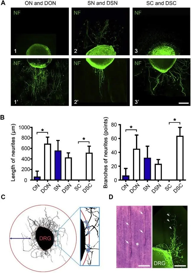 【客户文献解读】IF=10.317，Label-free揭秘脱细胞处理能优化视神经的抑制性微环境从而促进神经突生长