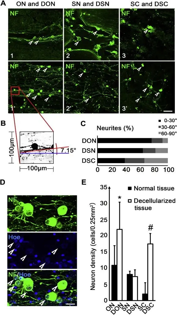 【客户文献解读】IF=10.317，Label-free揭秘脱细胞处理能优化视神经的抑制性微环境从而促进神经突生长