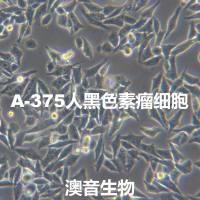 A375[A 375; A-375; A375-MEL; A375-mel; A375mel]人恶性黑色素瘤细胞