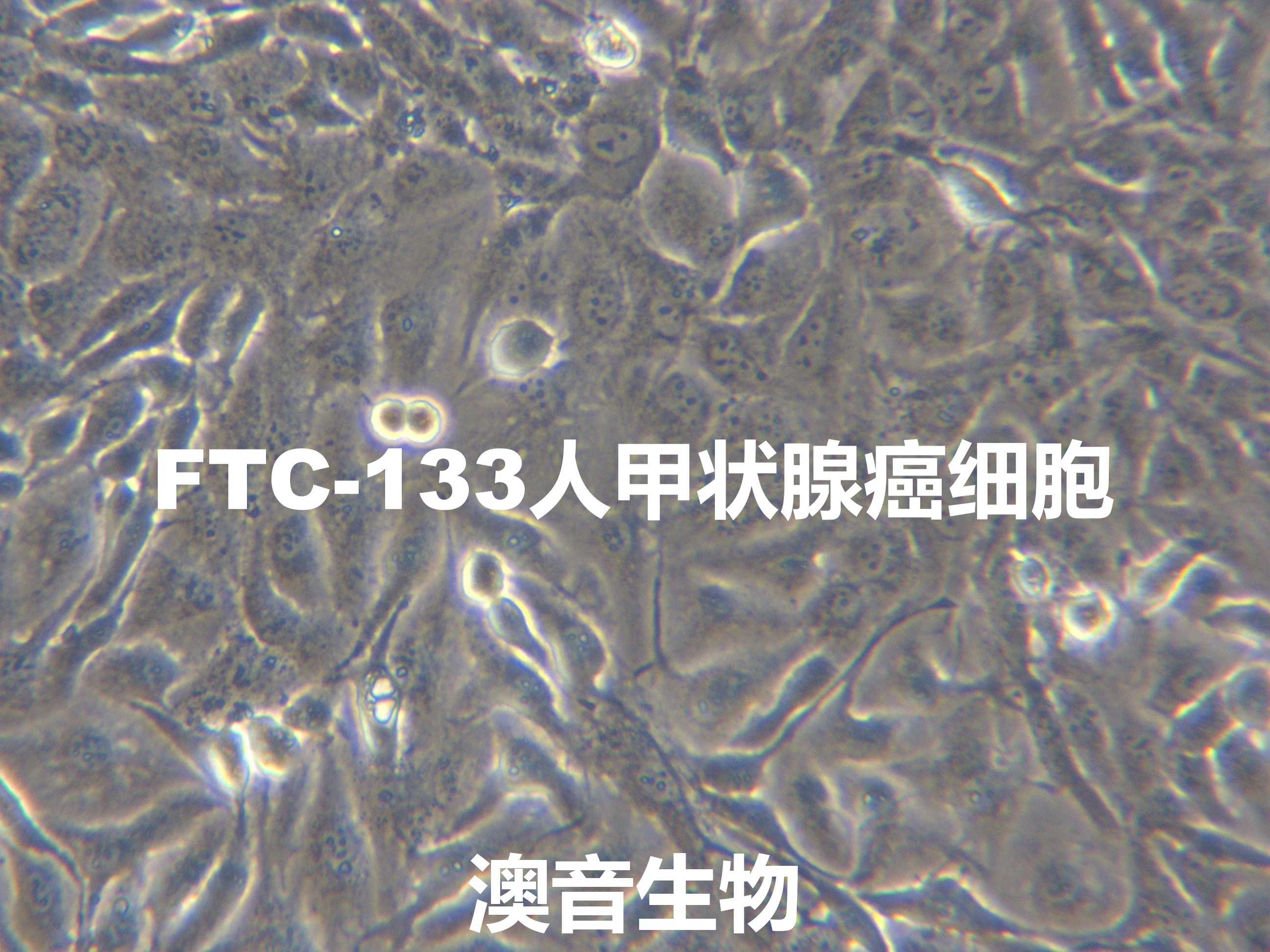 FTC-133[	FTC133]人甲状腺癌细胞