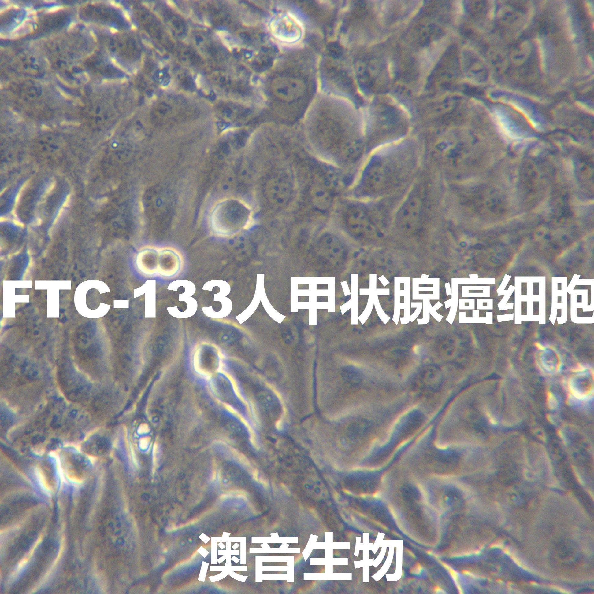 FTC-133[	FTC133]人甲状腺癌细胞