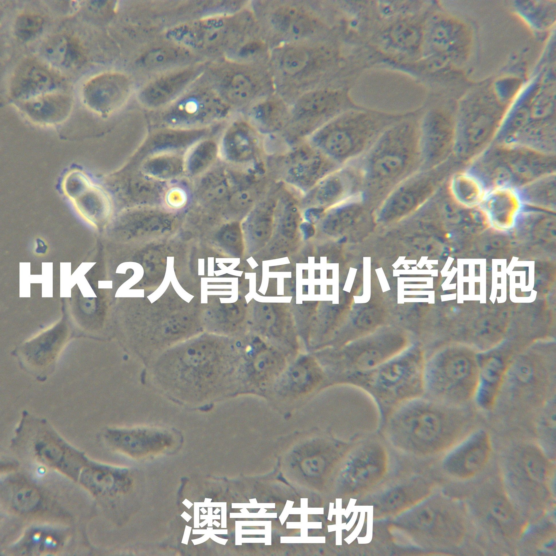 HK-2【Hk-2; HK2; Human Kidney-2】人肾近曲小管细胞