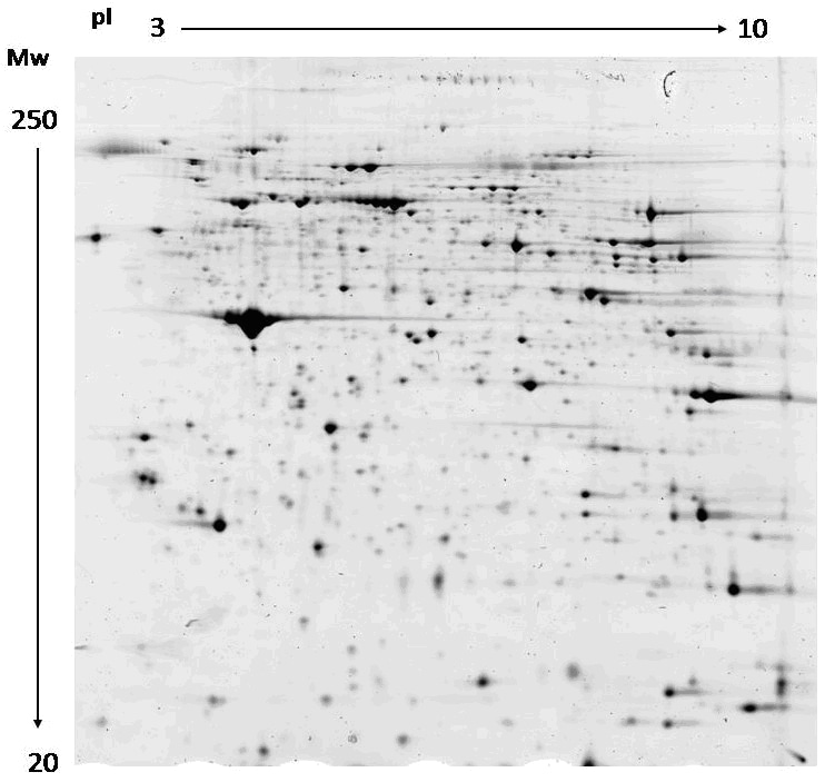 双向电泳图像分析