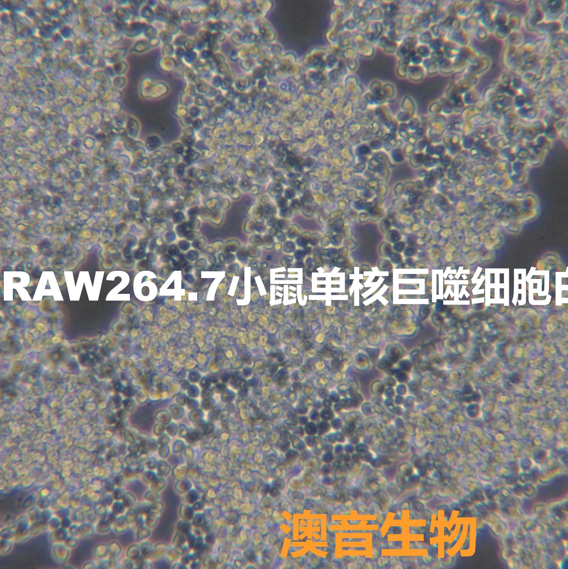 Raw264.7[RAW264; RAW2647; RAW264.7; RAW-264.7; Raw 264.7]小鼠单核巨噬细胞白血病细胞