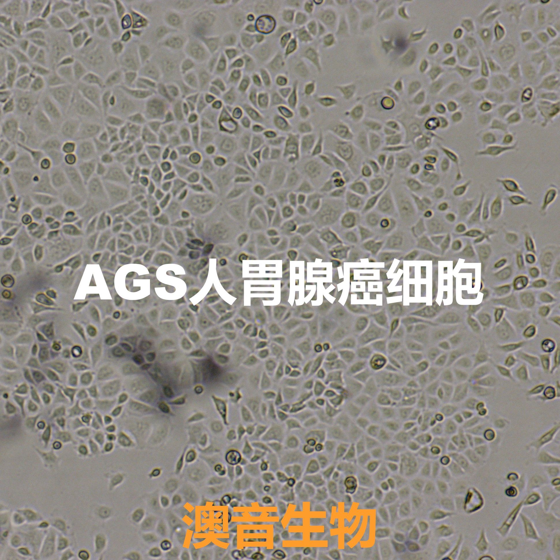 AGS|AGS细胞|人胃腺癌细胞