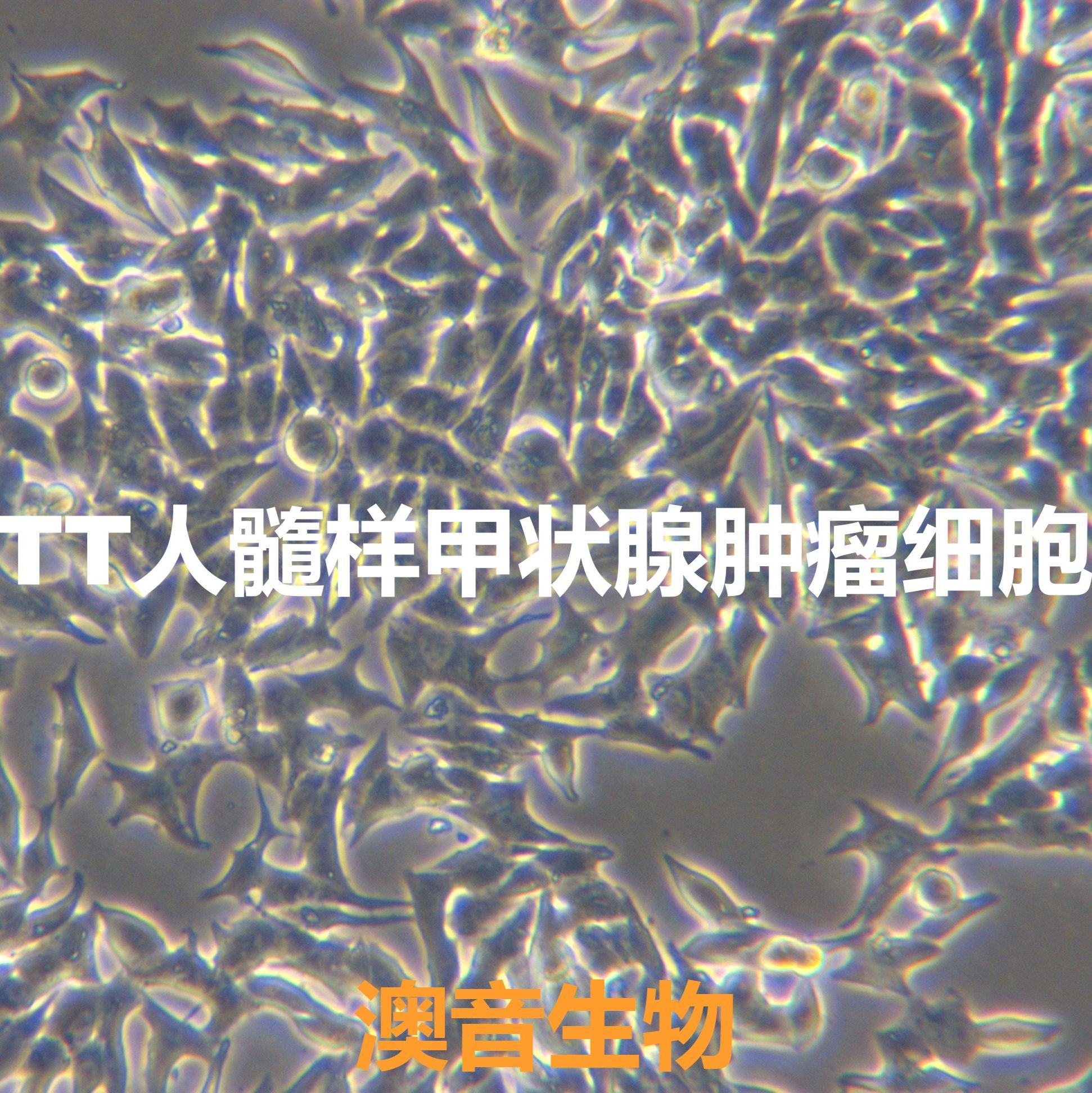 TT【MTC-TT;TT】人髓样甲状腺肿瘤细胞