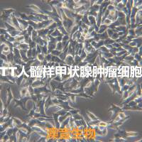 TT【MTC-TT;TT】人髓样甲状腺肿瘤细胞