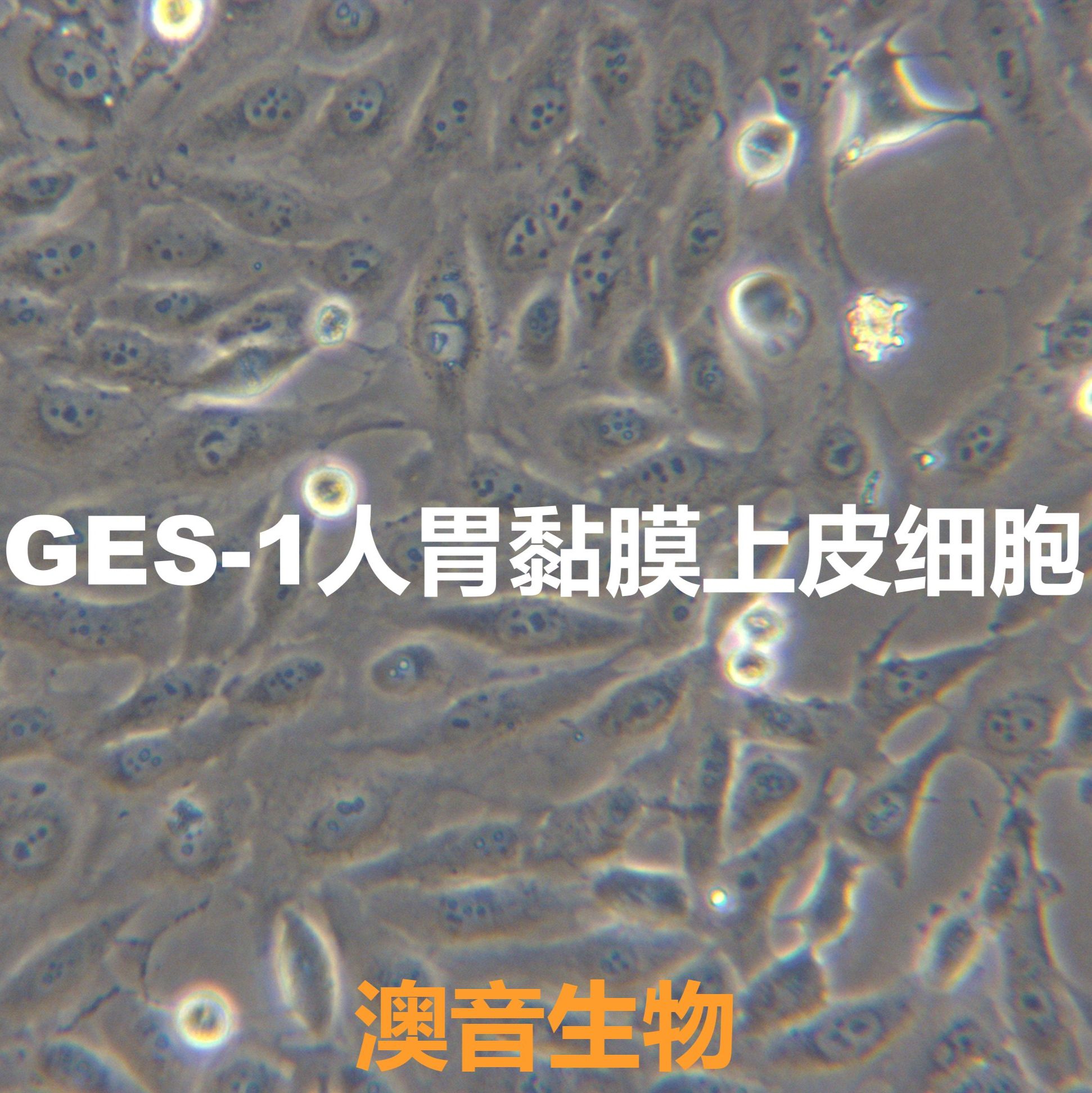 GES-1[GES-1;GES1]胃黏膜上皮细胞