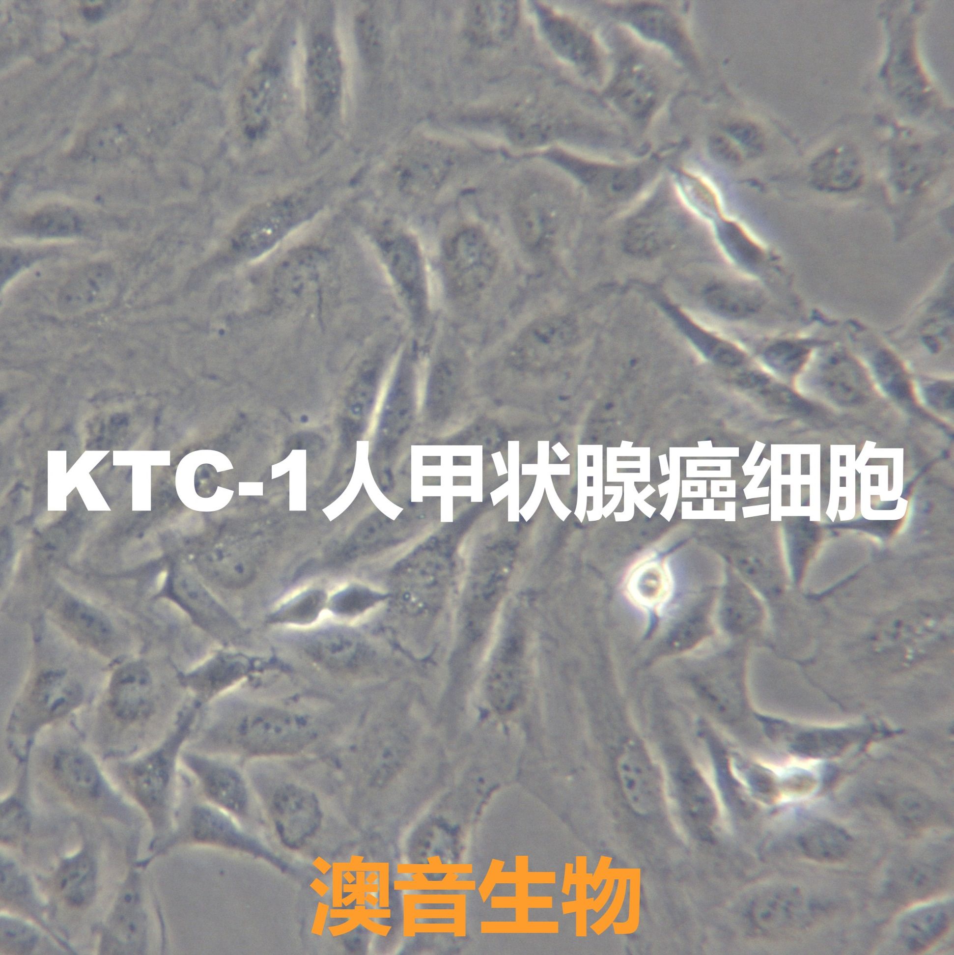 KTC-1【KTC1】人甲状腺癌细胞