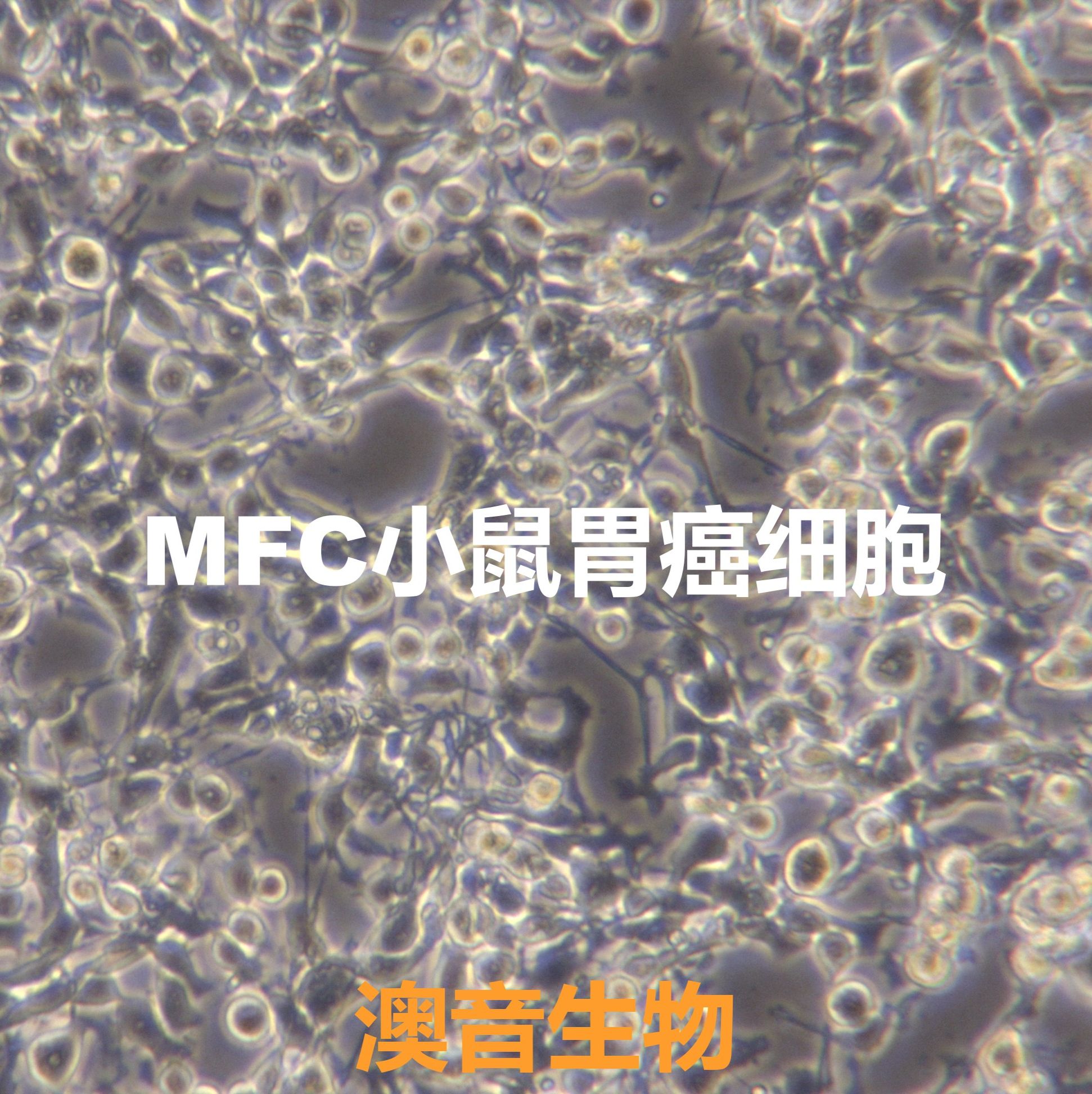 MFC【MFC;MFC;Mouse Forestomach Carcinoma】小鼠胃癌细胞