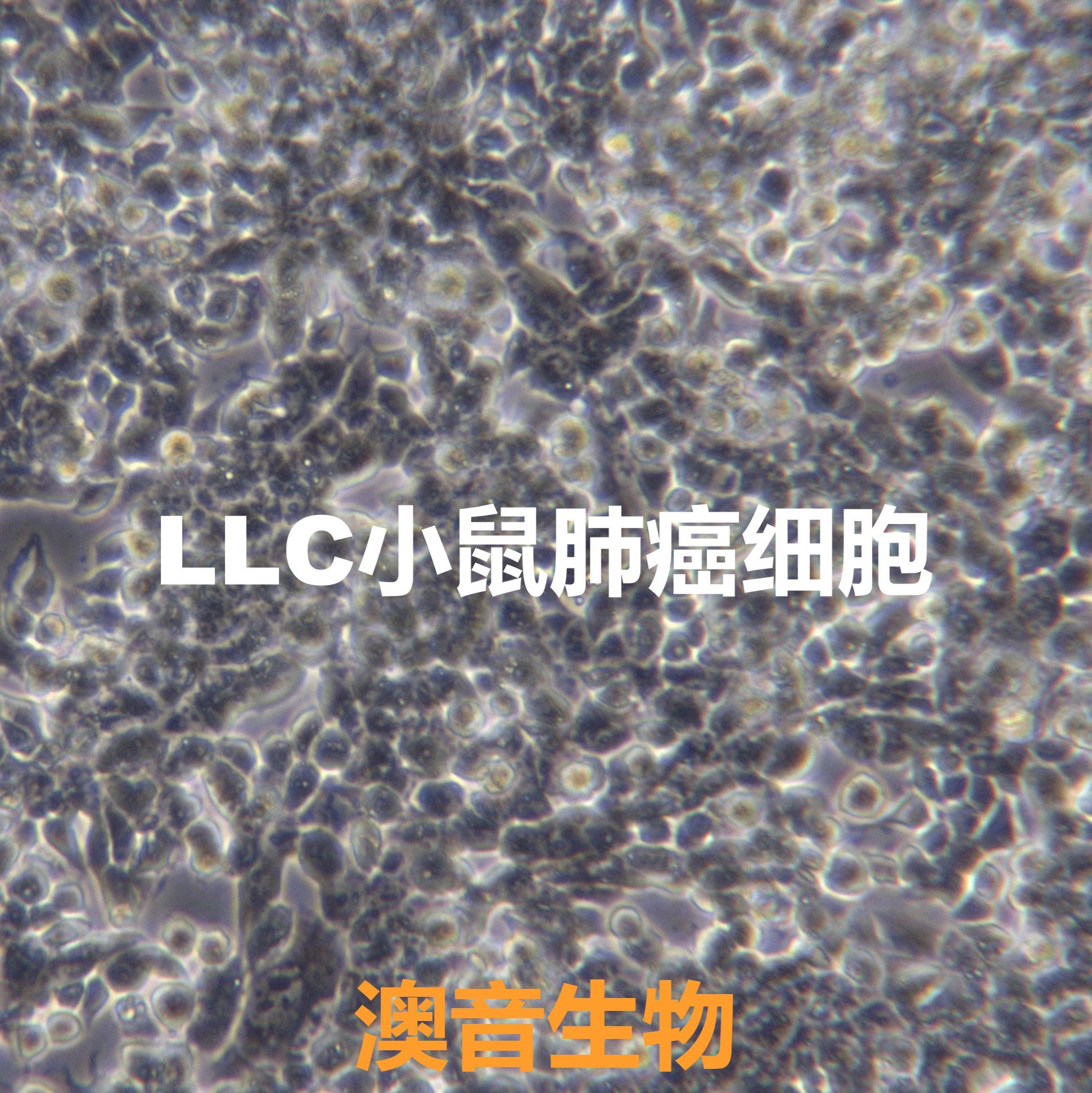 LLC【LL/2 (LLc1); LL/2(LLc1); LL/2; LL2; LLC1; Lewis lung carcinoma line 1; Lewis lung carcinoma; Lewis Lung Cancer; Lewis-Lung; Lewis Lung】小鼠肺癌细胞