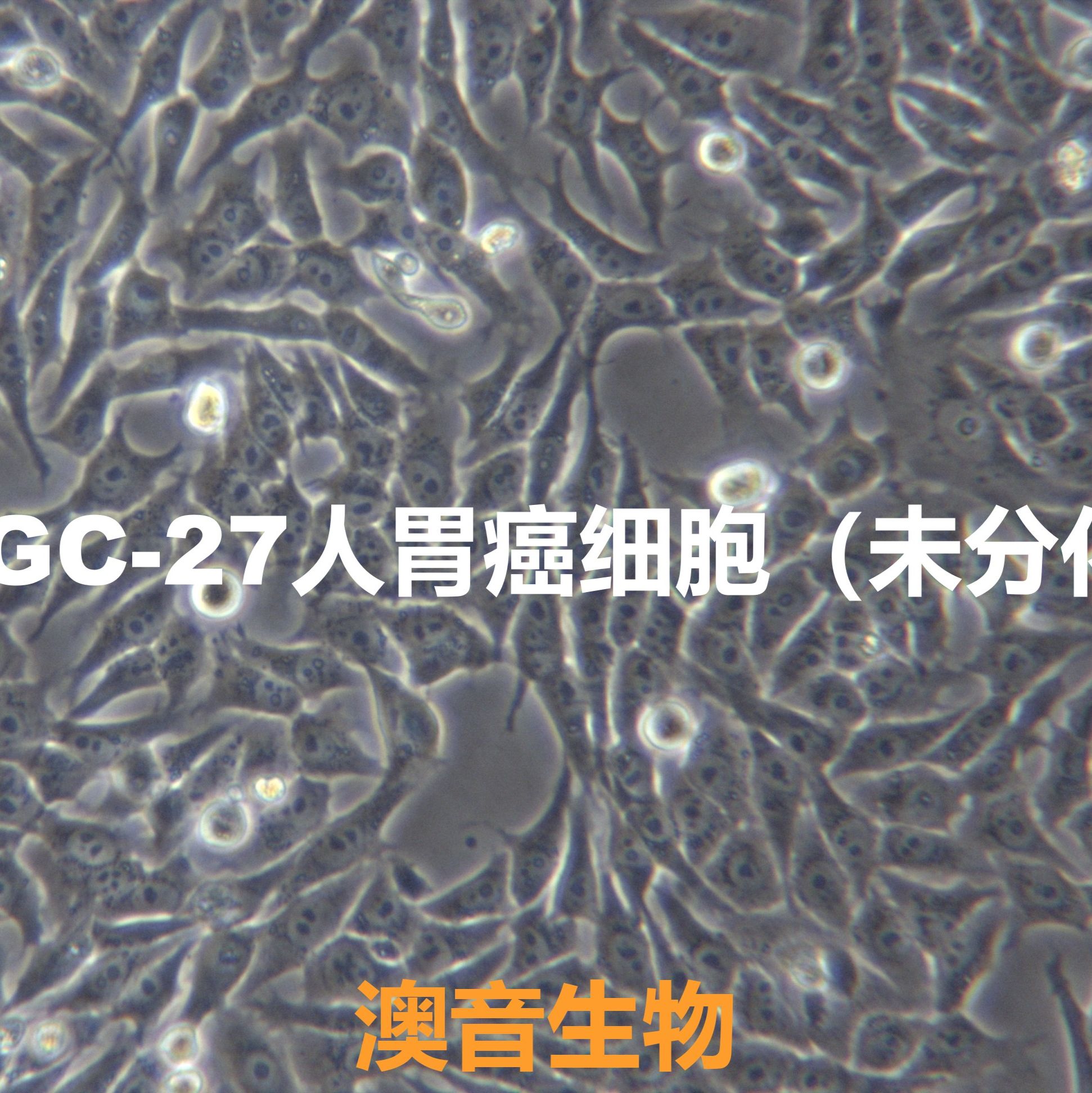 HGC-27[HGC 27; HGC27]人胃癌细胞（未分化）