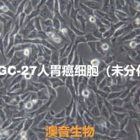 HGC-27[HGC 27; HGC27]人胃癌细胞（未分化）