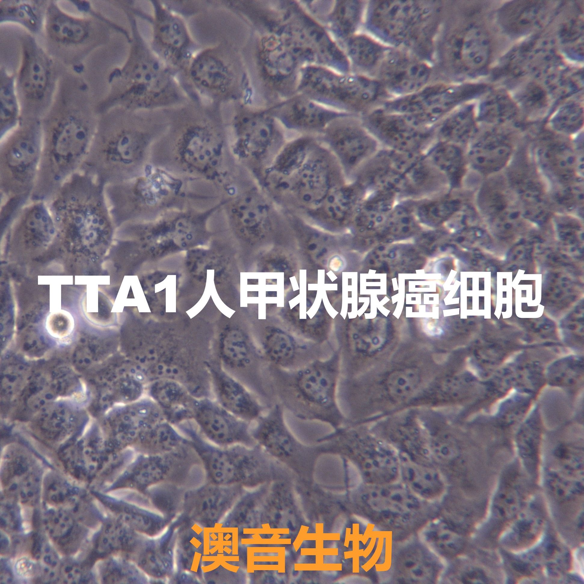 TTA1[TTA1; TTA-I]甲状腺癌细胞（未分化）