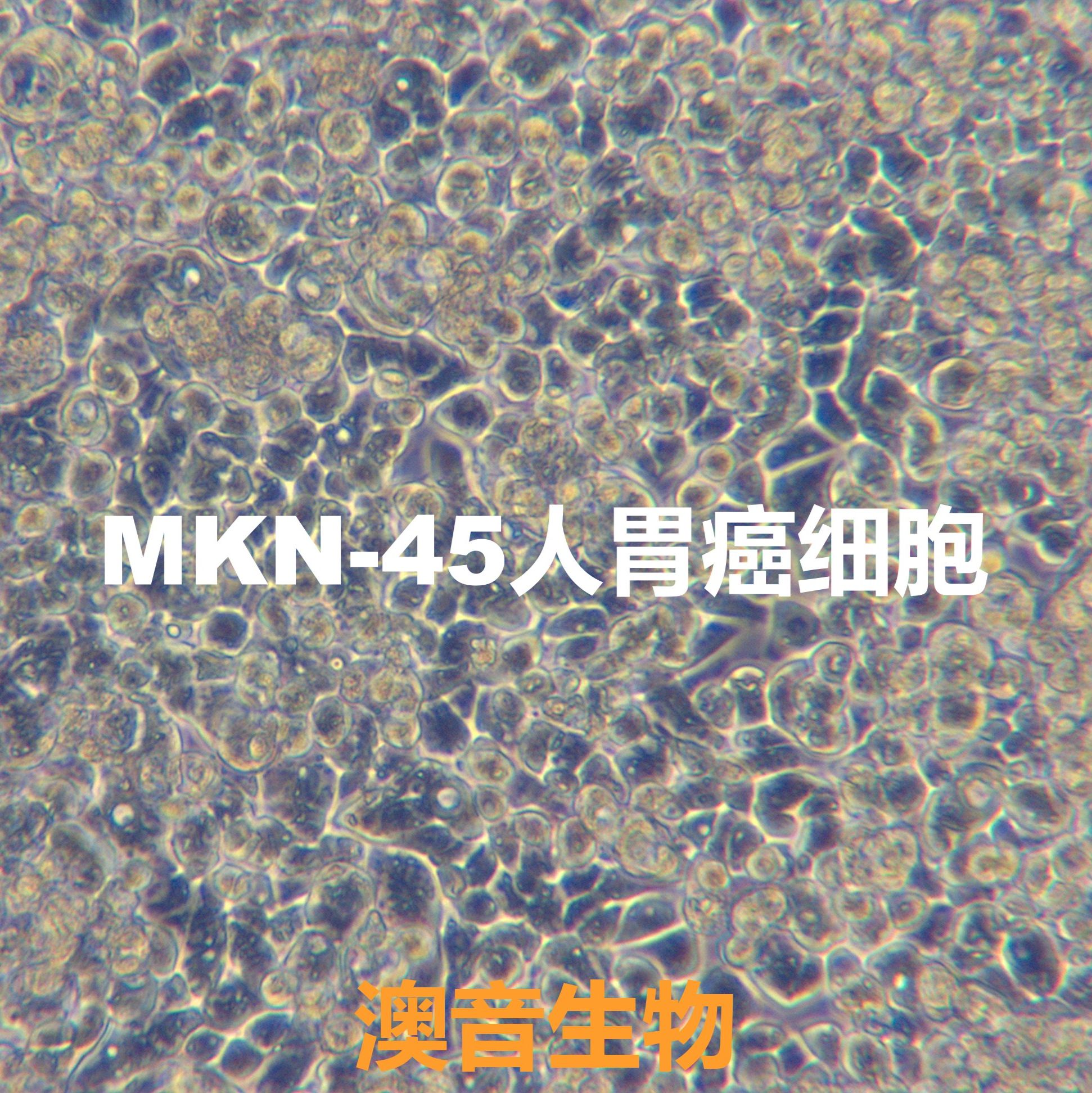 MKN45【MKN-45; MKN 45】人胃癌细胞