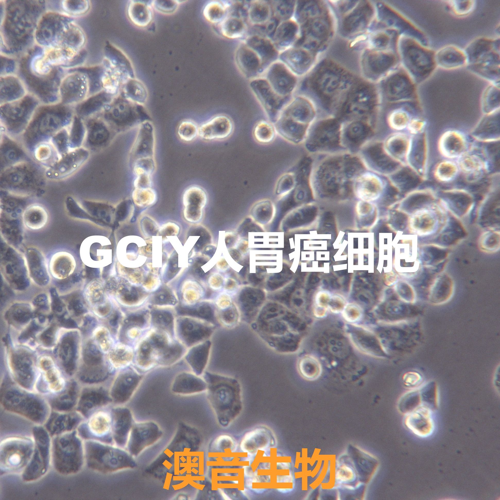 GCIY|GCIY细胞|人胃癌细胞