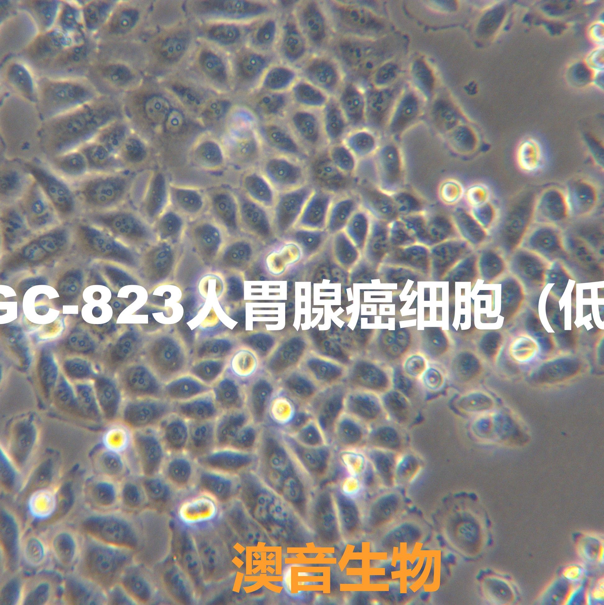 BGC-823[	BGC823]胃腺癌细胞（低分化）