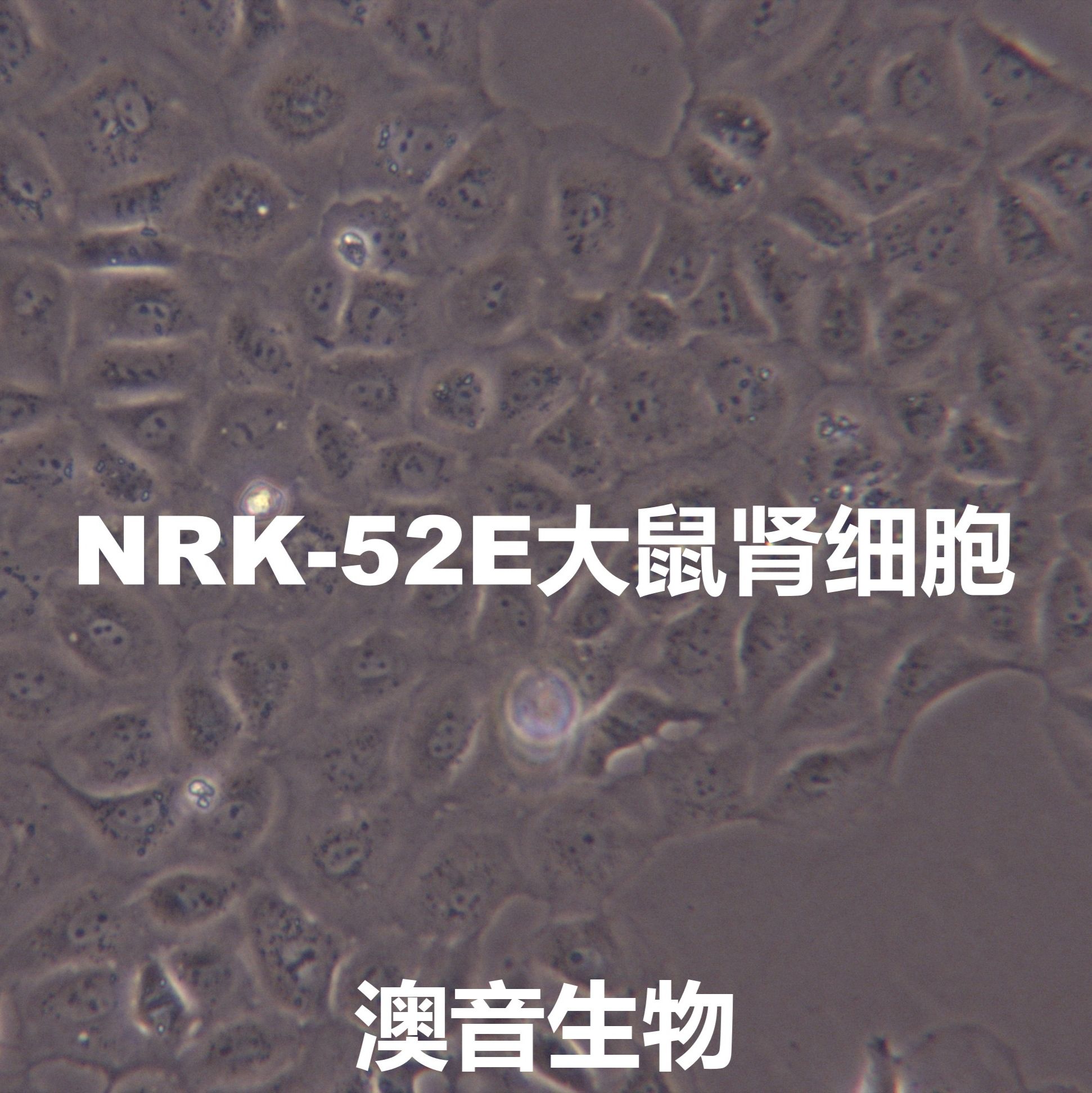 NRK-52E【NRK 52E; NRK52E; NRK clone 52E; Normal Rat Kidney-52E; NRK-E52】大鼠肾细胞