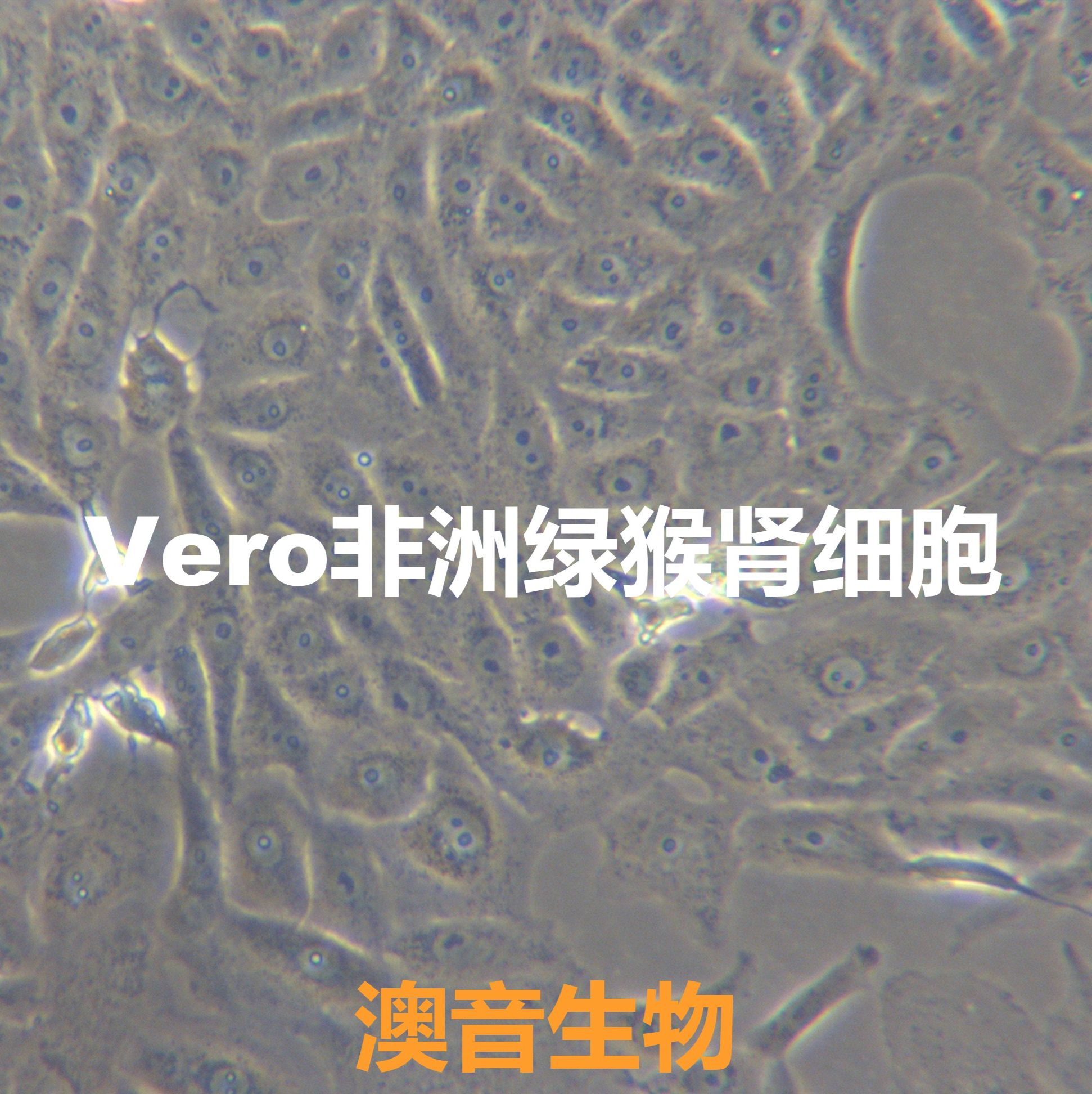 Vero[VERO; VeroCCL81; Verda reno]非洲绿猴肾细胞