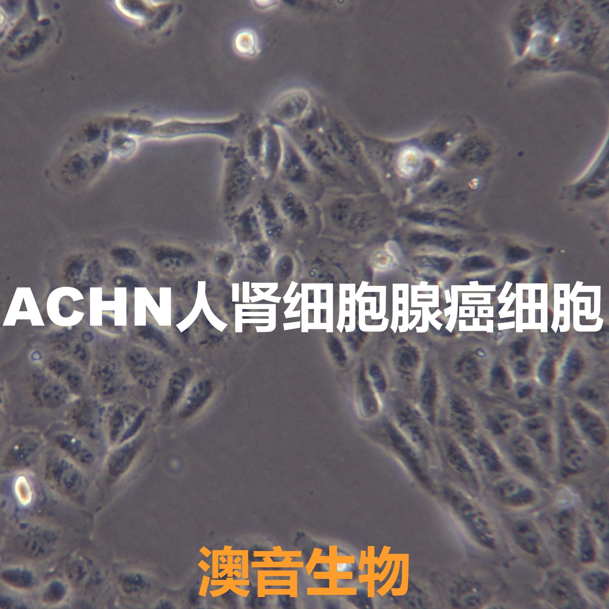 ACHN|ACHN细胞|肾腺癌细胞